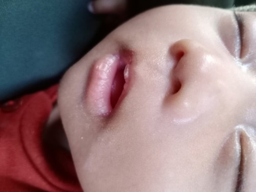Bund sharing dong. Anakq usia 2 bulan tapi bibir nya selalu kering dan pecah2 apakah normal?