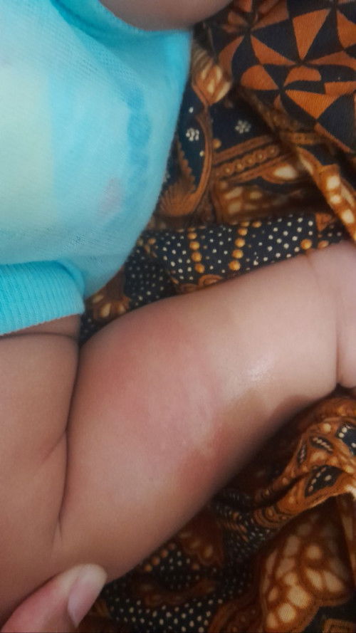 Seperti bekas kena ulat