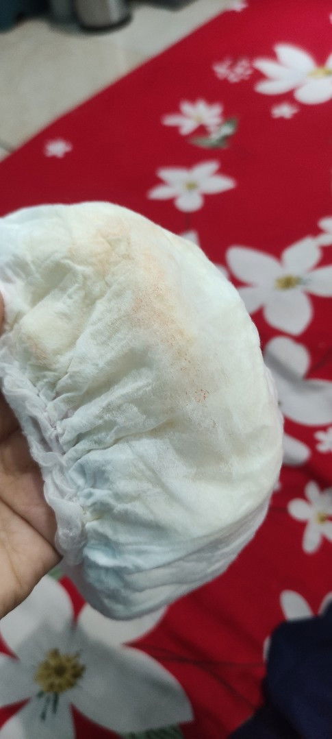 Timbul seperti jamur di kemaluan bayi