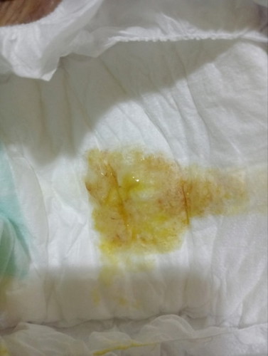 stool with mucus