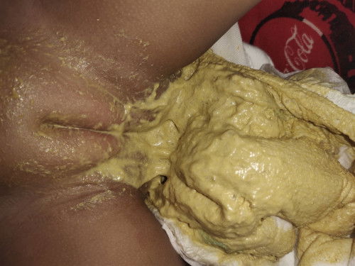 Hello mommies tanong ko lng po kung normal poop ba to ni baby?