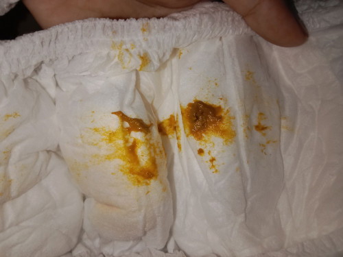 2 เดือน 23 วัน อุจะระ เหลืองเหนียว