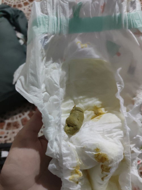 น้อง6m อึอึ้มาเป็นก้อน 2วัน