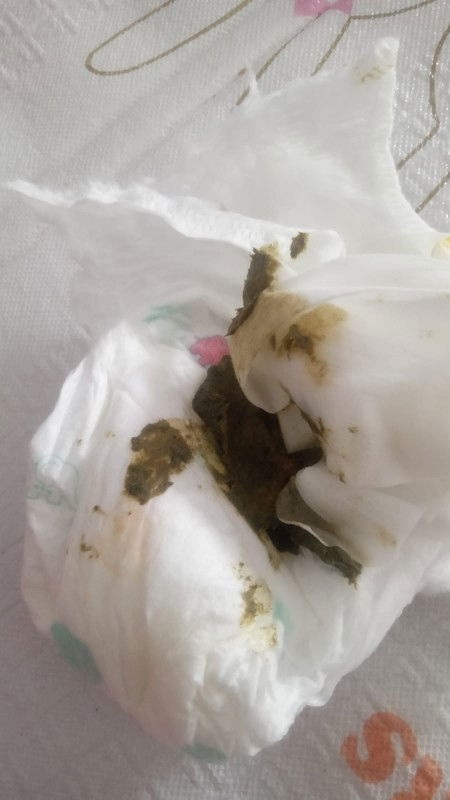 Diare pada bayi 7 bulan