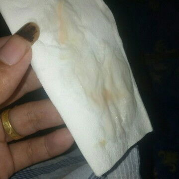 Flek lagi setelah obat penguat habis