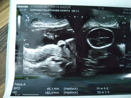 แบบนี้ไม่น่าผิดหวังใช่ไหมค่ะแม่ๆๆ