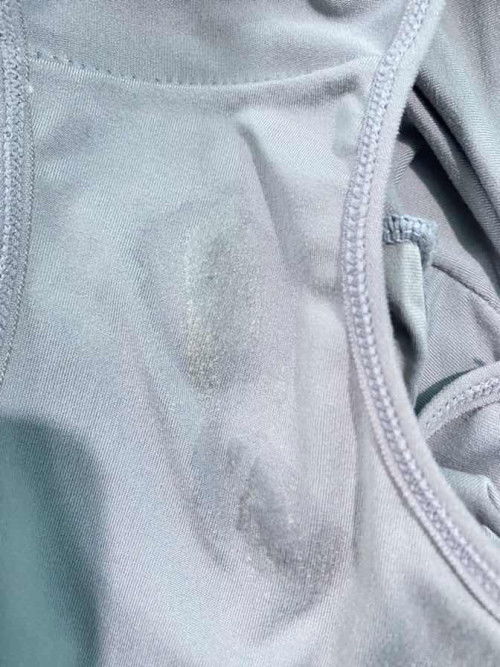 Ketuban rembes atau keputihan