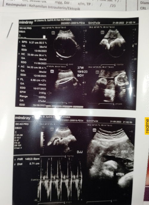 Semoga cepat dapet gelombang cinta 🥰 dan bisa lahir sebelum hpl