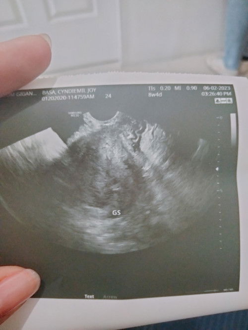 HELP🙏🙏🙏🙏