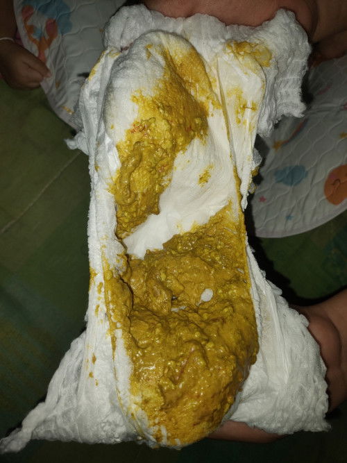 อึมีมูกเลือดถนน