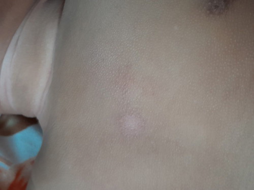 ใช้ยาอะไรทาดีคะ