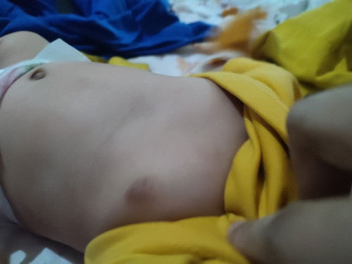 Bayi bru msuk 2bln. Kulitnya kygni pk apa ya biar sembuh?