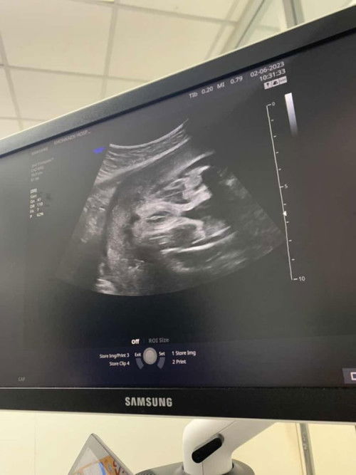 ทีมสิงหา 31+2w 🫶🏻