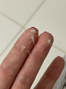 Thin and tissue paper like vaginal discharge