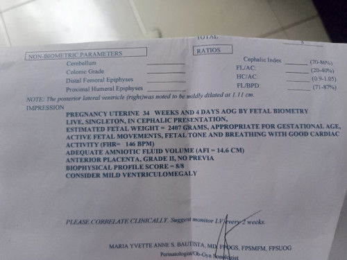 MILDLY DILATED LATERAL VENTRICLE