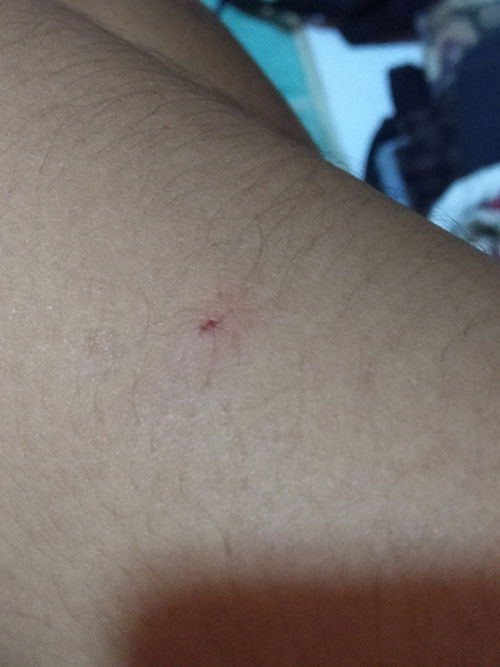 แมวกัดเล่นตอนท้อง