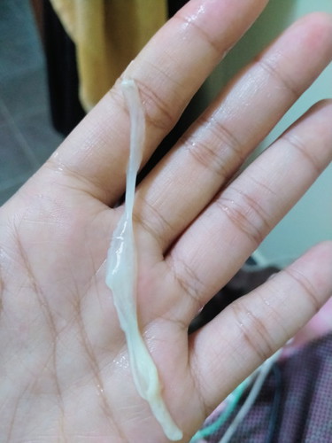 Keputihan atau lendir?