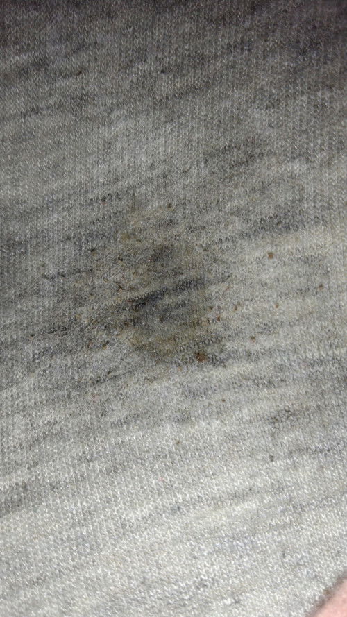 Mau nanya sekalian sharing ttg puting bun