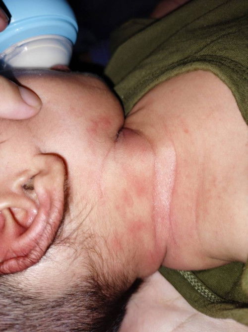 ขอสอบถามแม่ๆหน่อยค่ะ