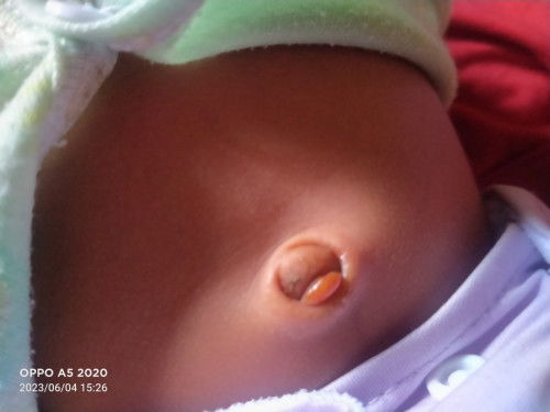 Normal tidak ya begini?