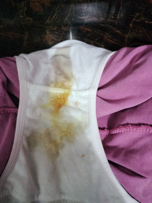 37 week EI ako tpus nilagyan nag Evening primrose oil. 3 hours nilabasan ako ganito ganun ba talag?