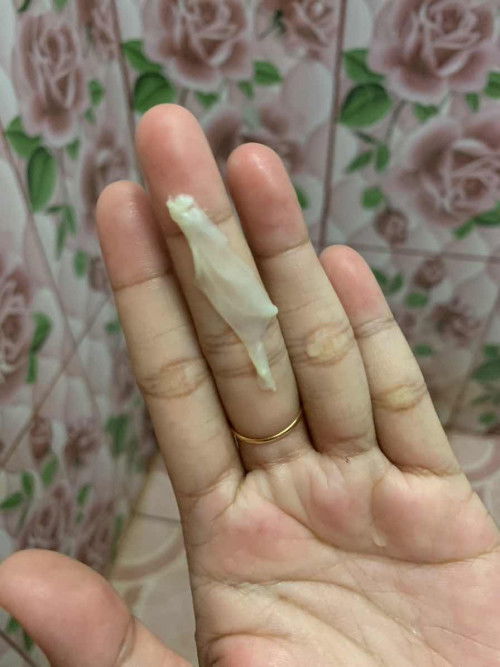 Keluar gumpalan putih gk berbau dan gk gatal,, apakah aman?