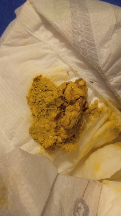 normal poba poop ni baby ko? 
nestogen switch to lactum