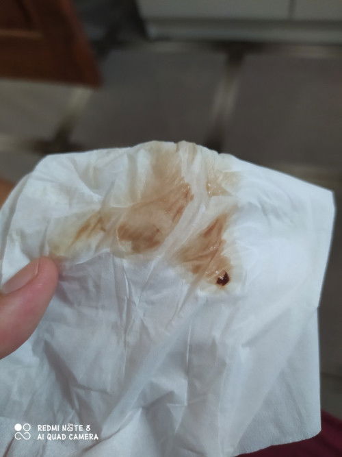 apa iya salah satu tanda