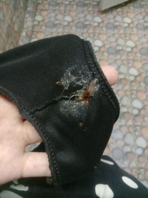 แบบนี้ควรทำไงดีค่ะแม่ๆ