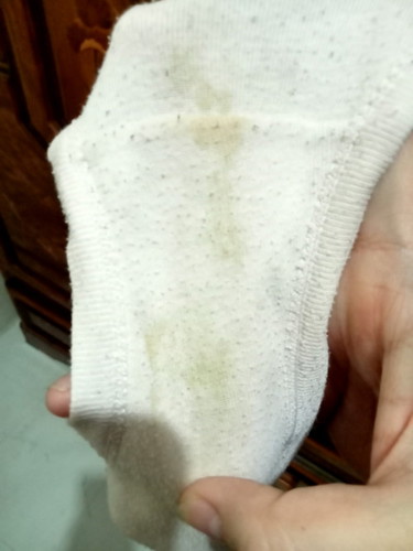 Discharge/spotting??
