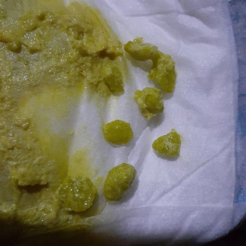 Perut kembung bayi 2 bulan