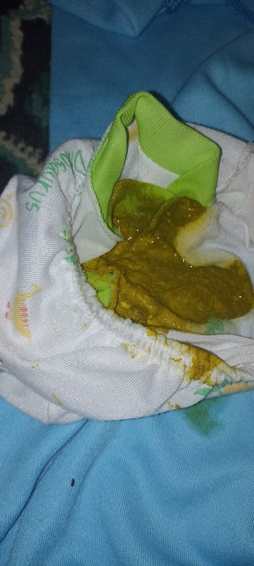 Ini termasuk diare atau enggak bund