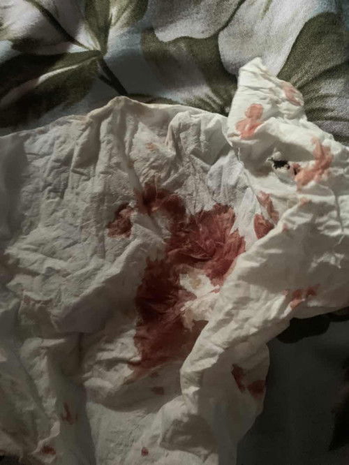 Apa ini keguguran ??