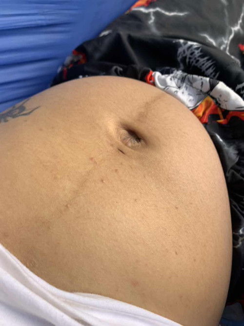 แบบนี้ปกติไหมคะ.