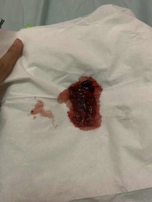 7 minggu ini keguguran