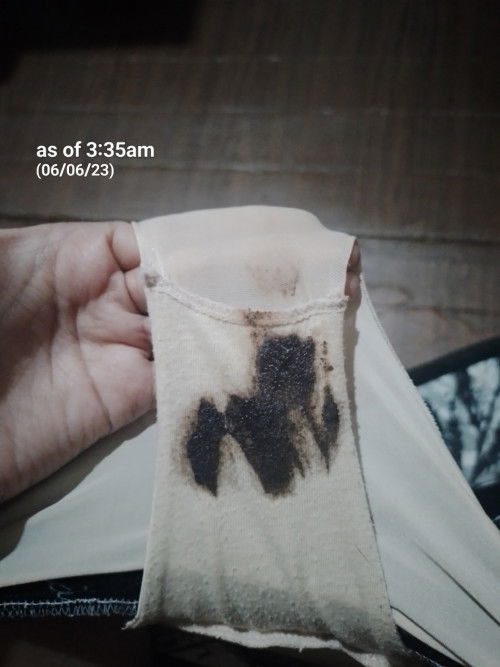 Dark Brown discharge at 4 weeks pregnancy