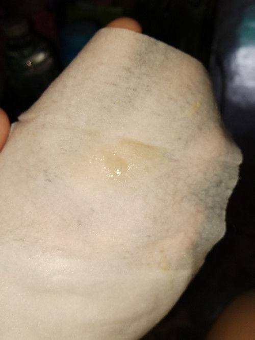 แบบนี้ใช่มูกเลือดมั้ยคะ.. 39+3 วีค