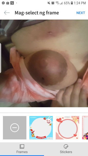 Mga mamsh ask lang namamaga dede ko ang tigas ano kaya to tagal ko ng hindi nag papa breast feed