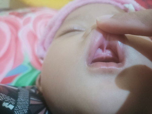 TUMBUH GIGI, SHARING