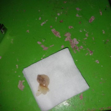 Bun mau tanya ini kenapa yaa tadi pas pipis di cd ada beginian 38week
Maaf jorok