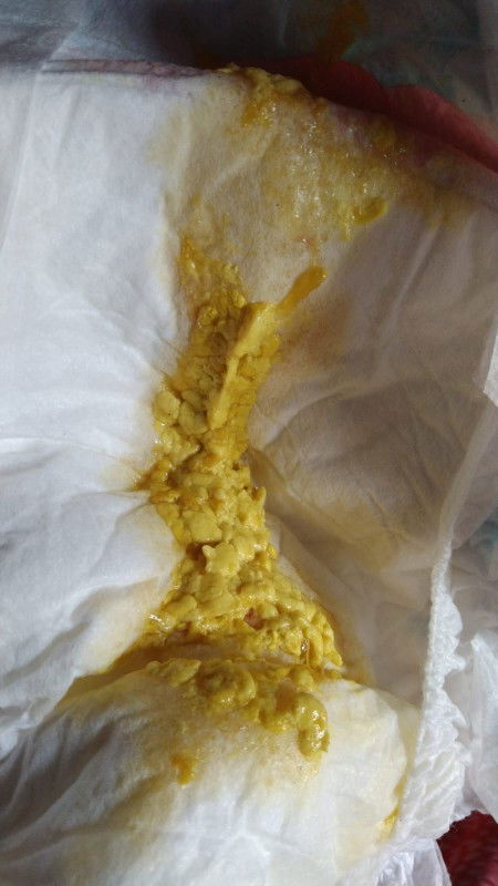 Pup bayi 2 bulan 16 hari