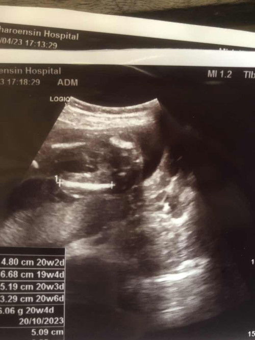 ช่วยดูทีคะ ผู้หญิง หรือ ผู้ชาย