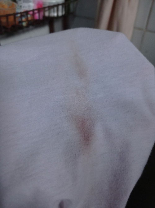 Plek usia kandungan 35 minggu