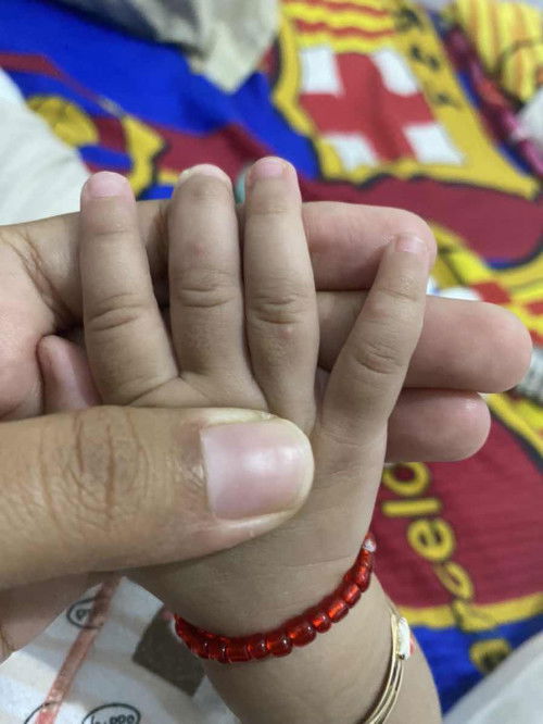 Bentol di jari bayi 5bulan