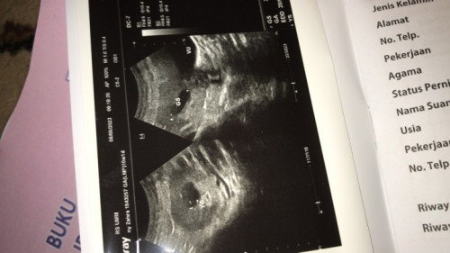 adakah usia 10 week yg masih kantong saja?