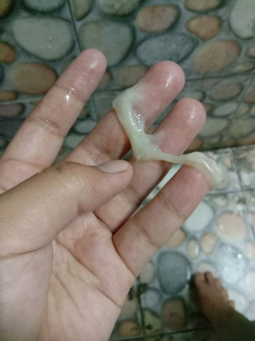 จะเป็นไรมั้ยหรอคะแม่ๆ