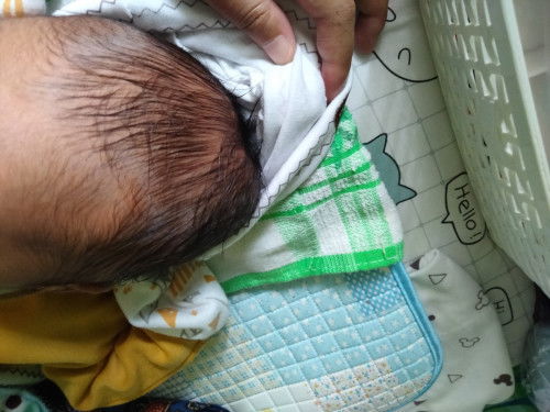 Kepala ada benjolan lunak