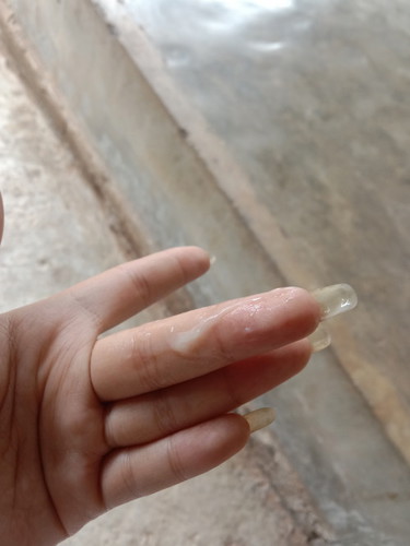 28วีคมีมูกใสๆ
