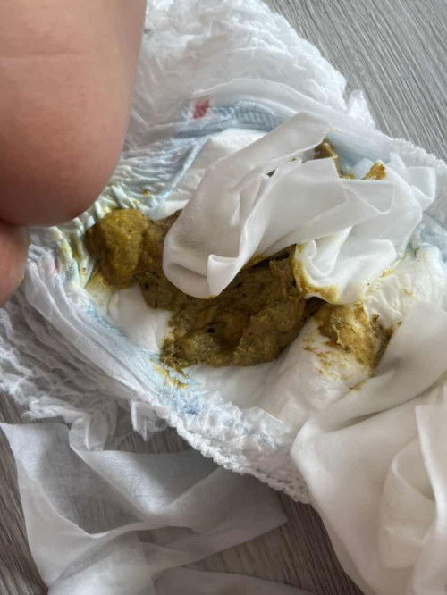 ลูกพึ่งกินตับไก่อุจจาระมีสีดำปน ปกติไหม