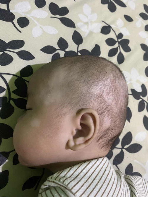 Putih putih di kepala